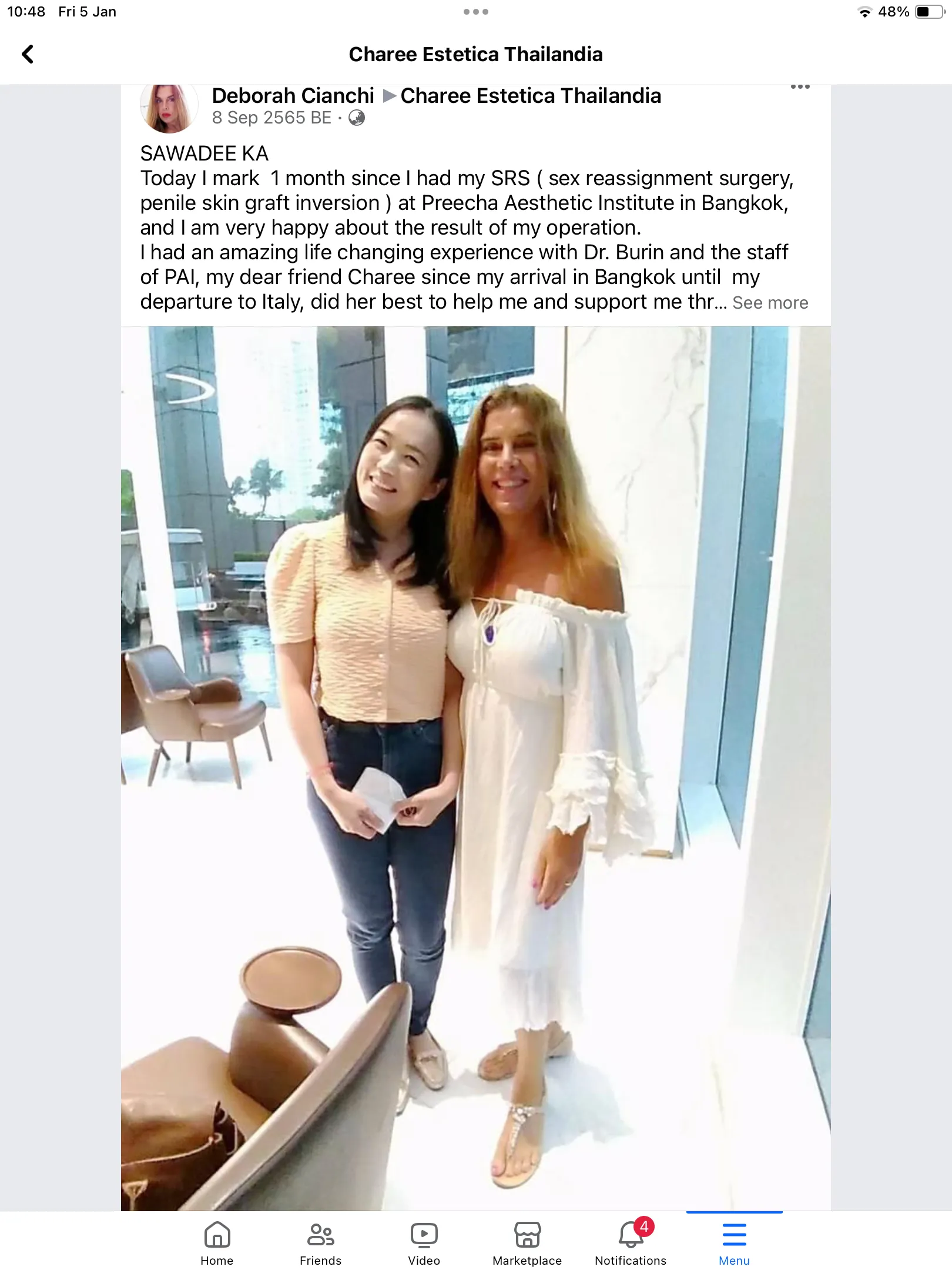 Deborah, Italy, sex reassignment surgery thailand, srs thailand